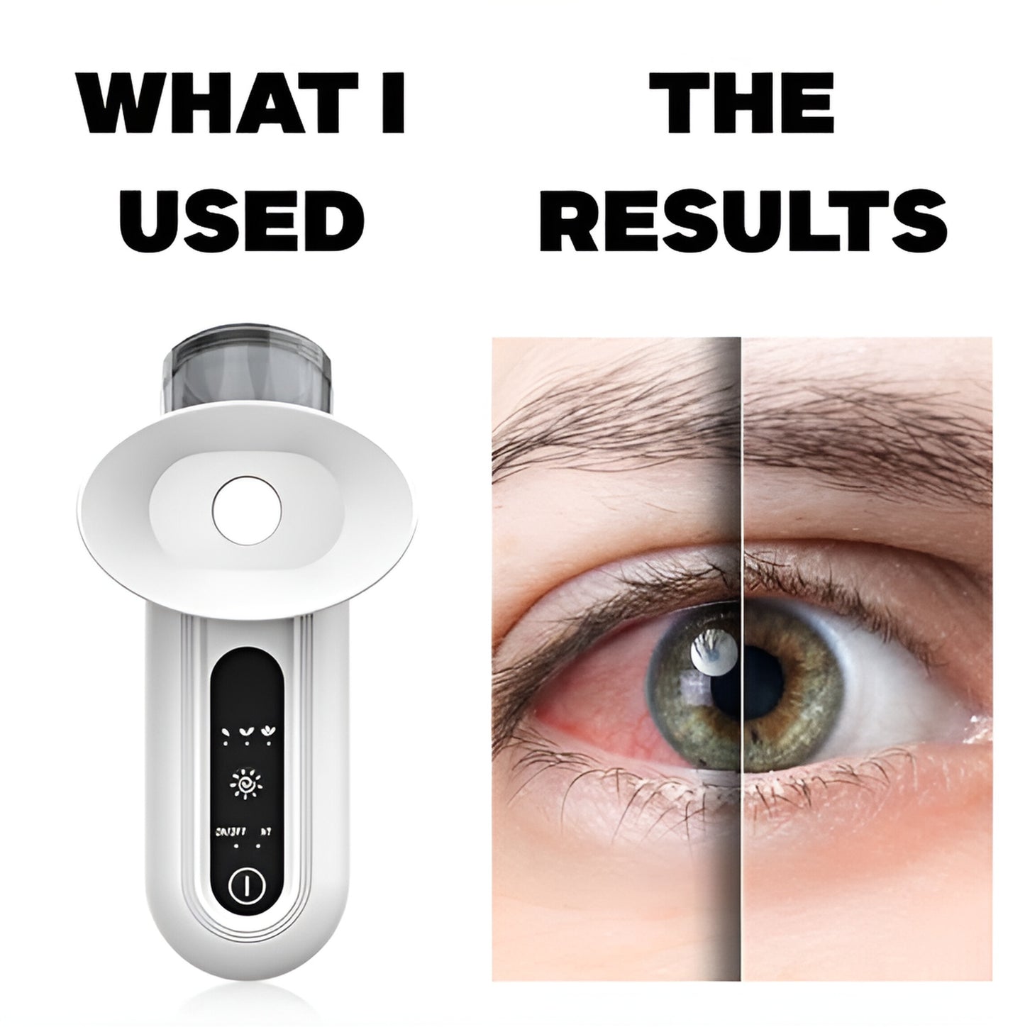 MediMist | Eye stream Therapy